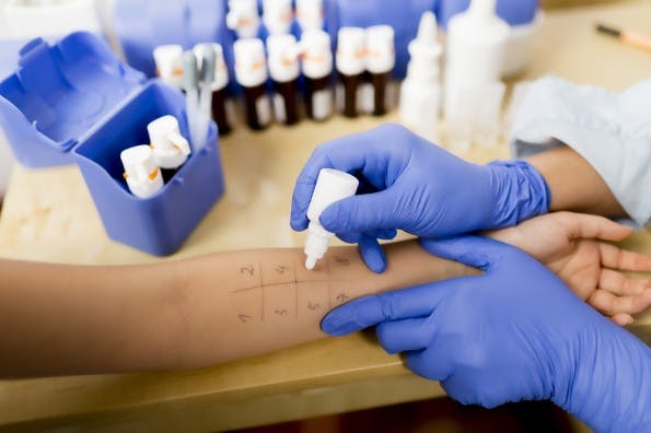 Auch Allergiker vor Produkten zu warnen, ist eine Option für Haiges. (Foto: Shutterstock / gorillaimages)