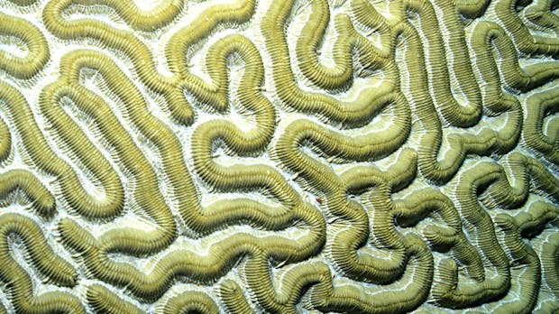 Brain-Hacking: Diese Startups haben es auf dein Gehirn abgesehen
