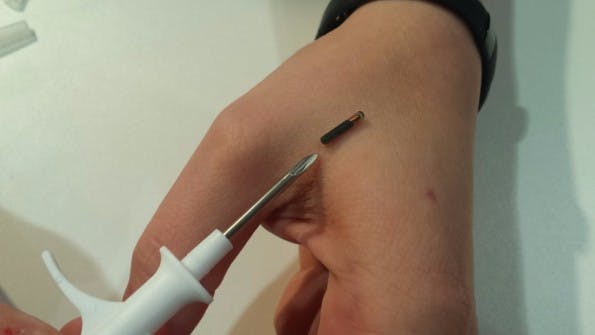 NFC-Chip unter die Haut – klein wie eine Kugelschreiber-Miene. (Bild: t3n.de)