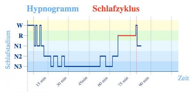 Hypnogramm mit einem Schlafzyklus – hier folgte nach kurzem „Wachliegen“ (W) etwas Leichtschlaf (N1), unterbrochen von erneutem Wachwerden, danach etwas Schlaf der Stadien N2 und ausgiebig Tiefschlaf (N3) sowie 13 Minuten REM-Schlaf (R). (Grafik: Wikipedia)