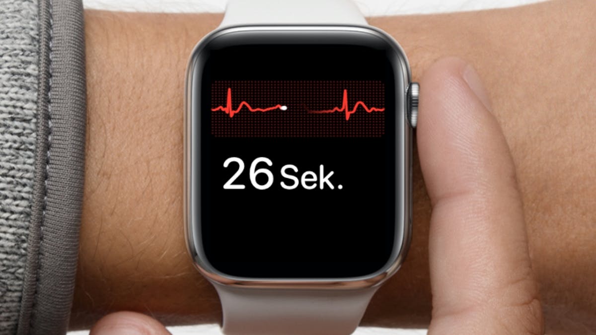 Apple Watch Ekg Uneindeutig Apple Watch Ekg Uneindeutig