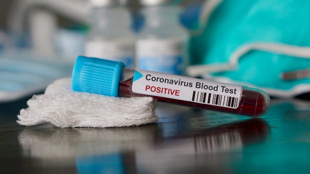Coronavirus: Deine Rechte und Pflichten im beruflichen Umfeld