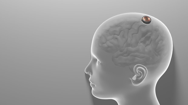 Elon Musks Neuralink-Mitgründer Max Hodak ist gegangen
